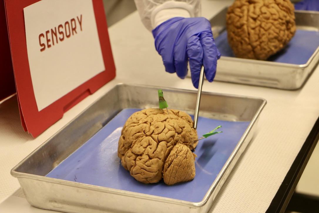 brain sample in lab